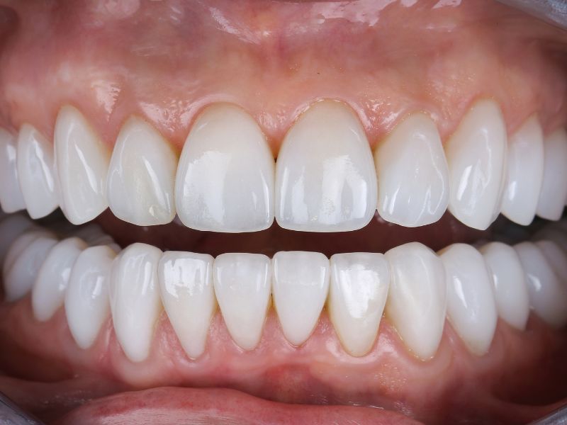 فناوری‌های جدید در طبیعی شدن کامپوزیت